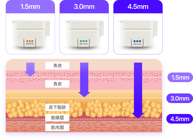 表皮&真皮 : 1.5mm, 皮下脂肪 表層 : 3.0mm, 皮下脂肪 深層&筋膜層&筋肉層 : 4.5mm