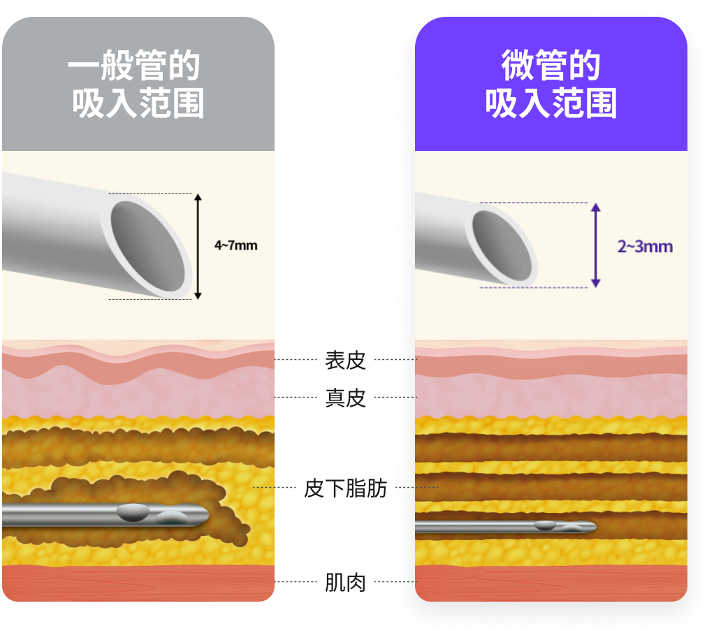 突出线条的LITING的吸入要点